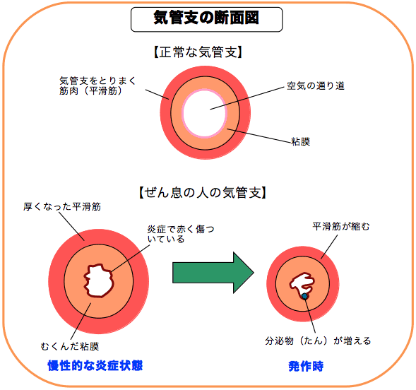 気管支の断面図