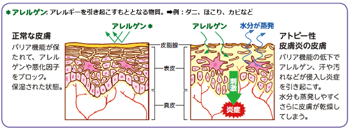 アレルギーを引き起こすもととなる物質の説明図