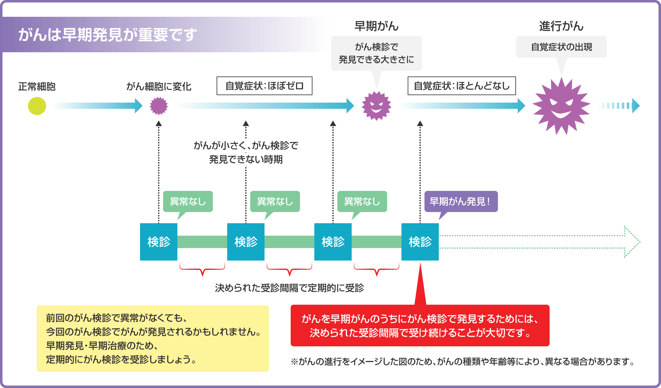 がん進行：イメージ