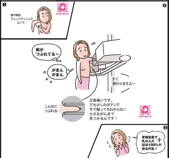 乳がん検診