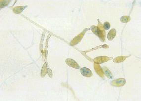 Alternaria alternata2