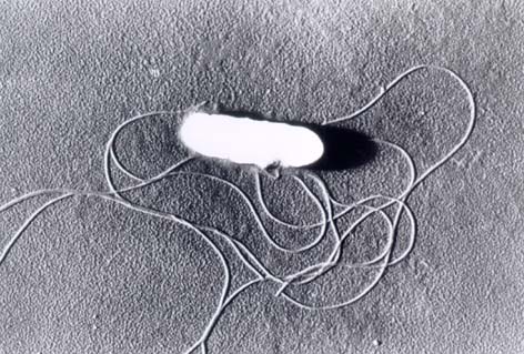 Photo:Listeria monocytogenes