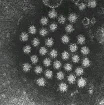 Photo：Norovirus