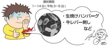 生焼けハンバーグ、レバー刺しなどが原因食