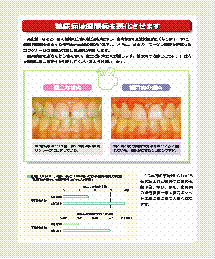 画像　糖尿病と歯周病～その密接な関係～リーフレット　裏