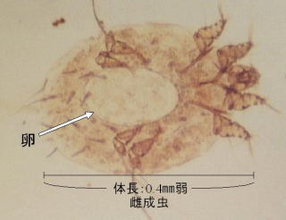 写真　ヒゼンダニ雌成虫